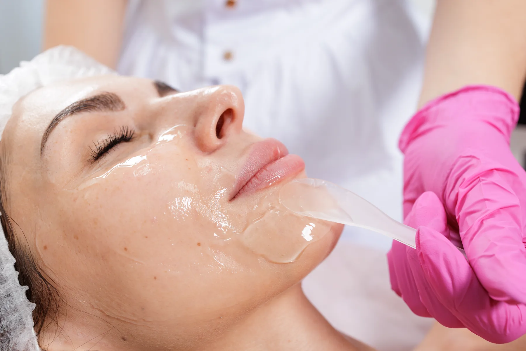 Chemical peel treatment being applied to the face