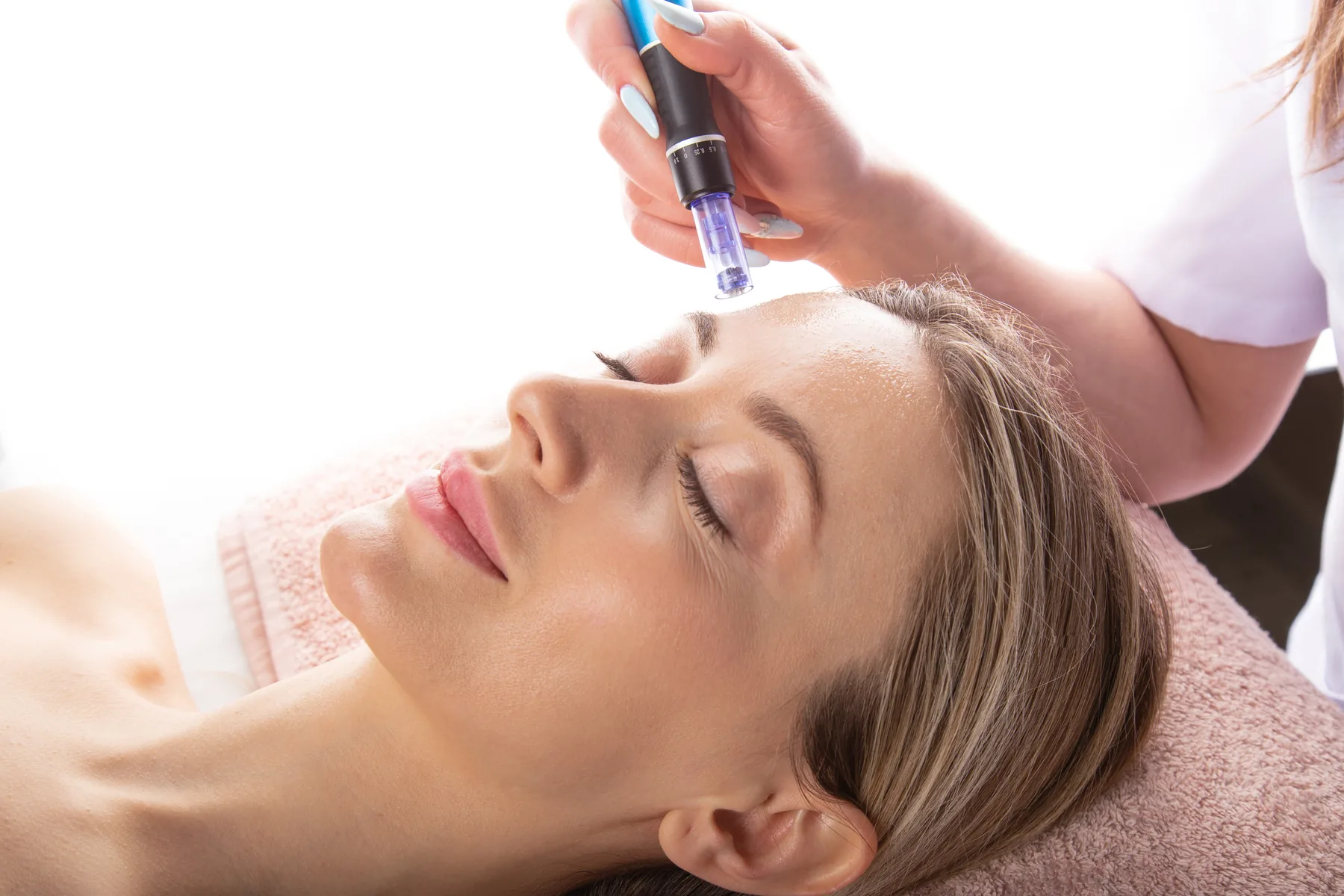 SkinPen Precision microneedling treatment at SOLAÉ