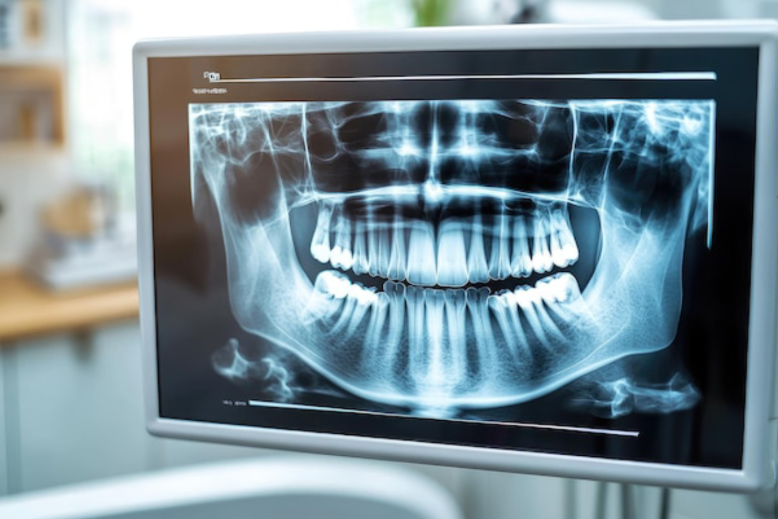 Dental Radiography